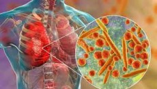 Mycoplasma Pneumoniae Terdeteksi di Indonesia, Kemenkes: Tetap Disiplin Prokes