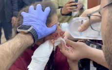 Meski Kelelahan, Tim Medis di Gaza Terus Berjuang Menolong Korban Luka Akibat Genosida