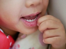 Kenali Penyebab dan Solusi Bibir Kering pada Anak, Hindari Mitos Membasahi Bibir