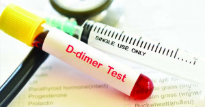 Waspada Nilai D-Dimer Meningkat pada Pasien Post Covid 19