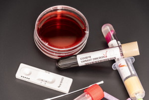 Aturan Baru, PPDN Belum Booster Wajib Tunjukkan Tes Antigen dan PCR