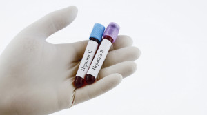 Seberapa Serius Penyakit Hepatitis Misterius? Ini Kata Pakar