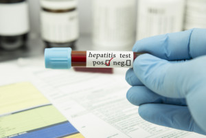 Kemenkes Ungkap 6 Dugaan Penyebab Hepatitis Akut