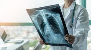 Rokok Elektrik Lebih Sehat, Siapa Bilang? Ini Faktanya