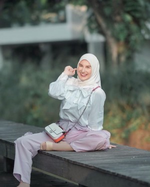 Senyum Makin Manis, Ini Pesona 5 Artis Bergigi Gingsul