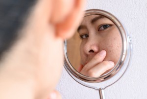 Tips Mengatasi Skin Barrier Rusak, Begini Kata Dokter Kecantikan