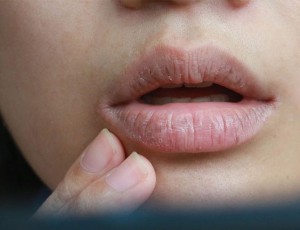 Waspadalah, 7 Tanda di Wajah Ini Indikasikan Penyakit Tertentu