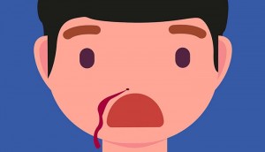 Telinga Serasa Kemasukan Air? Bisa Jadi Itu Gejala Awal Kanker Nasofaring