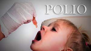 Kasus Polio Muncul Lagi, Pakar UM Surabaya Beri Pesan Ini