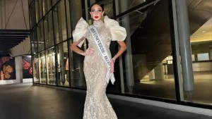 Raih Gelar Miss Universe Mesir, Logina Salah Buktikan Vitiligo dan Status Ibu Bukan Halangan