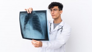 Dokter Anjurkan Perokok Aktif Diatas 45 Tahun Wajib Skrining Kanker Paru