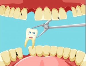 Tips Jaga Kesehatan Gigi Agar Tidak Ompong saat Menua