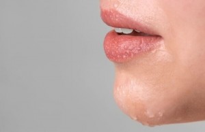4 Tips Hilangkan Bibir Pecah-pecah dan Keriput
