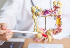 Usus Buntu: Mengenal Penyebab, Gejala, dan Pencegahannya
