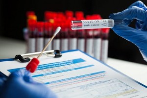 Pemerintah Tindak Tegas RS dan Lab yang Nakal Tarif Tes PCR
