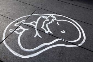 Bolehkah Korban Pemerkosaan Lakukan Aborsi? Begini Pendapat Ulama