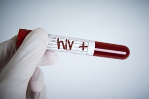 Ratusan Mahasiswa Terinfeksi HIV, Seks Bebas Jalur Penularan Pertama