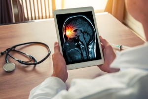 Soal Kelangkaan Vaksin Meningitis, Kemenag Koordinasi dengan Otoritas Arab Saudi