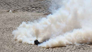 Dosen Kedokteran UM Surabaya: Bahaya Gas Air Mata Sebabkan Kebutaan