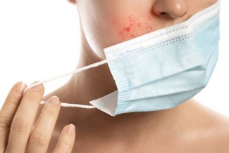 Pakai Masker Terlalu Lama Sebabkan Jerawat, Ini Solusinya