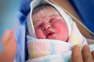 Kenali Kulit Bayi, Mulai dari Vernix Caseosa hingga Pilih Skincare