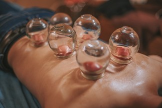 Mengenal Bekam, Terapi Sunnah Nabi dalam Pandangan Ilmiah