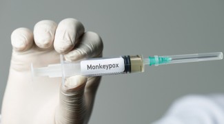 Wagub DKI Sebut Pasien Pertama Cacar Monyet Tinggal Indekos di Jakarta