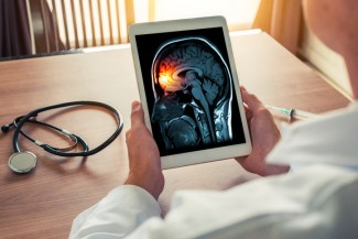 Mengenal Meningitis, Gejala, Penyebab hingga Pencegahannya