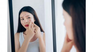 7 Penyebab Jerawat Sering Muncul, Bikin Tidak Percaya Diri