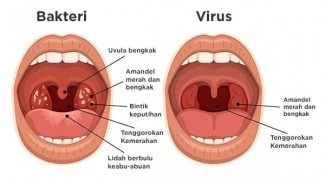 Radang Tenggorokan Mau Menelan Saja Terasa Sakit