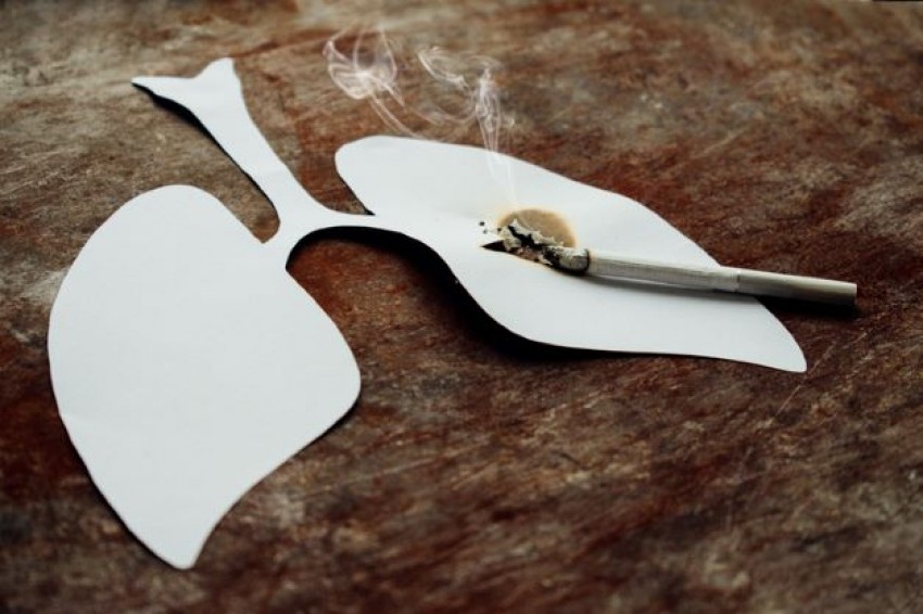 Hati-hati, Merokok Masih Jadi Penyebab Utama Penyakit Paru Obstruktif Kronis