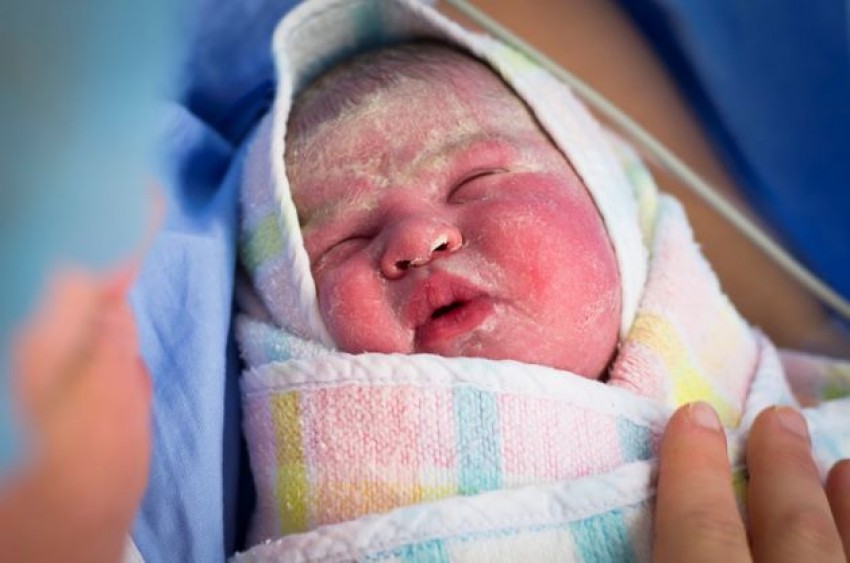 Kenali Kulit Bayi, Mulai dari Vernix Caseosa hingga Pilih Skincare