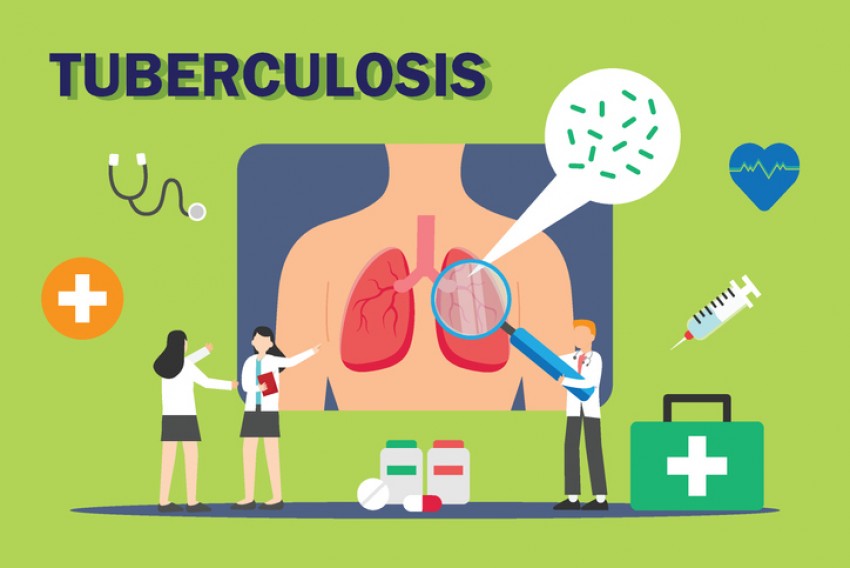 Potensi Penularan Tinggi, Kemenkes segera Skrining TBC Besar-Besaran