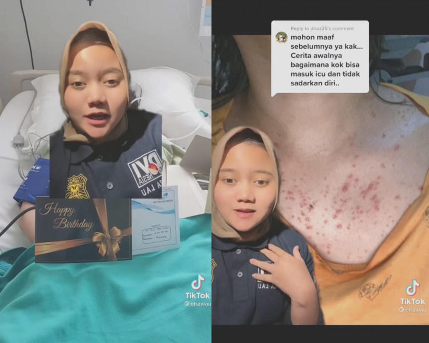 Perempuan Terkena Stroke di Usia 20 Tahun, Kok Bisa?