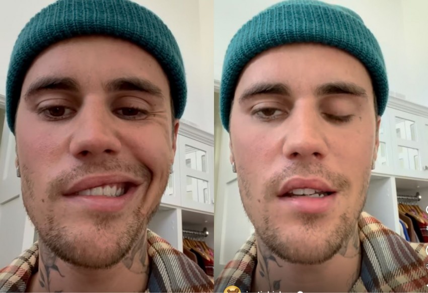 Amati Gejala Ramsay Hunt: Ruam, Vertigo, hingga Bicara Cadel