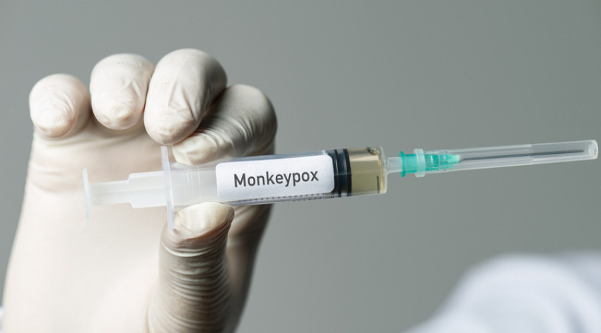 Cegah Penyebaran Cacar Monyet, Pemerintah Diminta Siapkan Vaksin