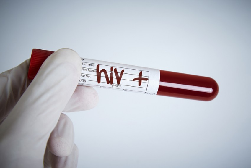 Ratusan Mahasiswa Terinfeksi HIV, Seks Bebas Jalur Penularan Pertama