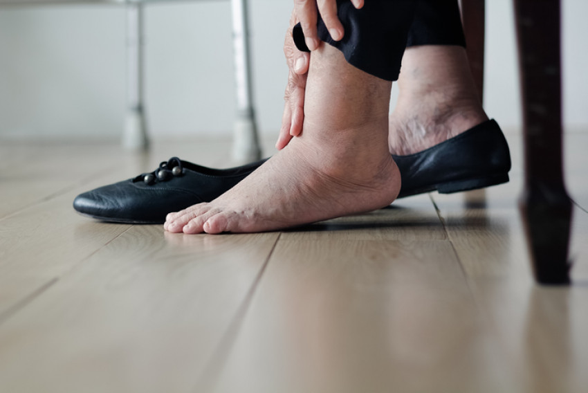 4 Cara Rawat Kaki Kering dan Pecah-Pecah di Musim Hujan
