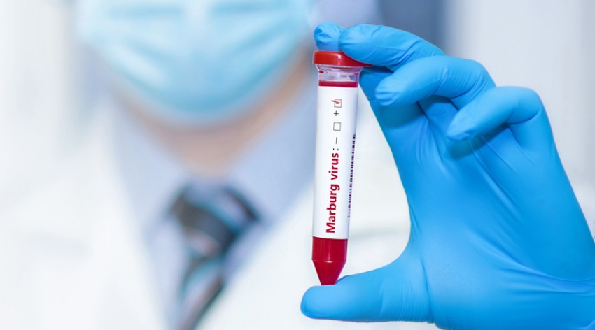 Netty Aher Minta Pemerintah Siapkan Langkah Pencegahan Virus Marburg