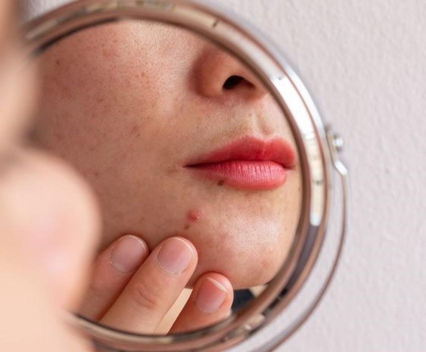 6 Langkah Cerdas Cegah Kulit Rusak Akibat Udara Buruk