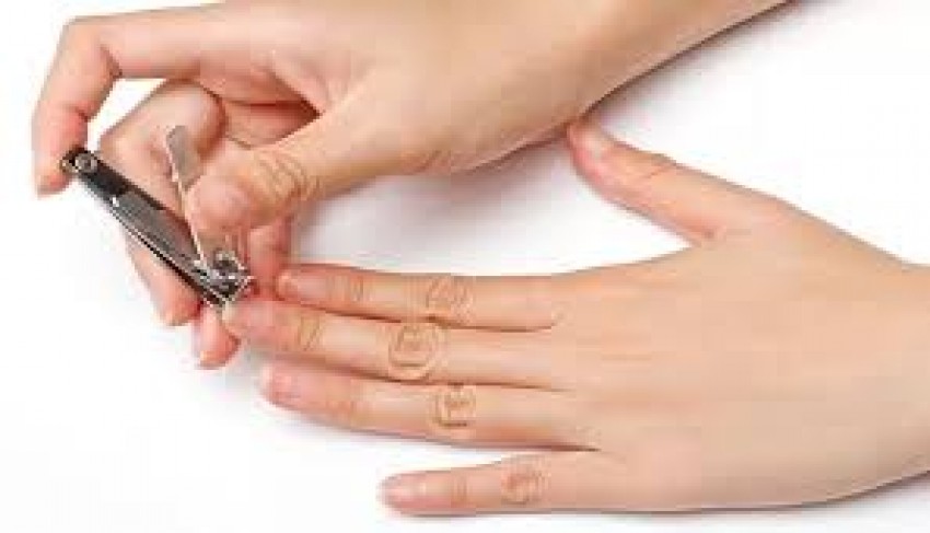 Bolehkah Orang yang Berkurban Memotong Kuku & Rambut? Ini Hukumnya