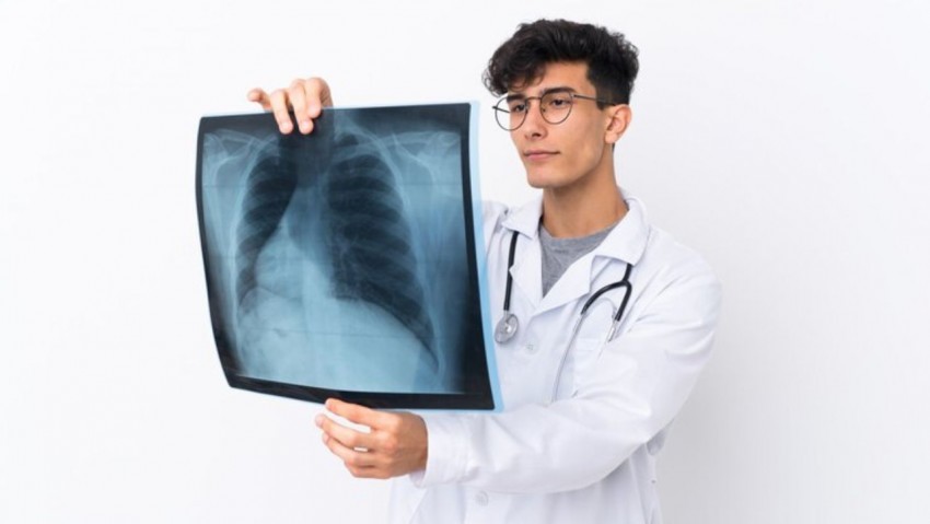 Dokter Anjurkan Perokok Aktif Diatas 45 Tahun Wajib Skrining Kanker Paru