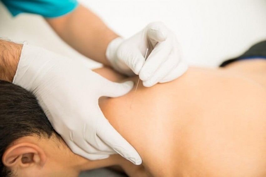 Metode Baru Turunkan Berat Badan lewat Akupuntur di Telinga
