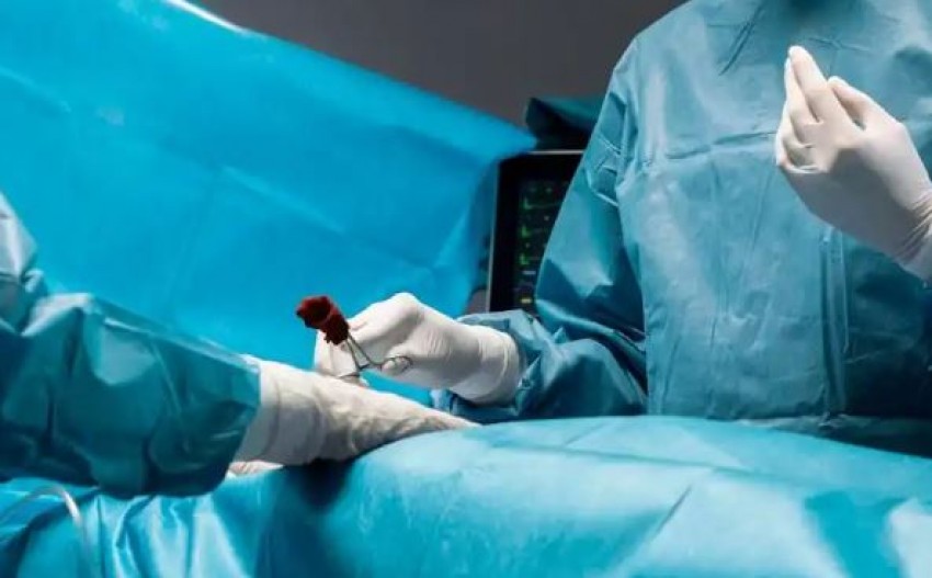 Hukum Vasektomi dalam Islam, Bolehkah?