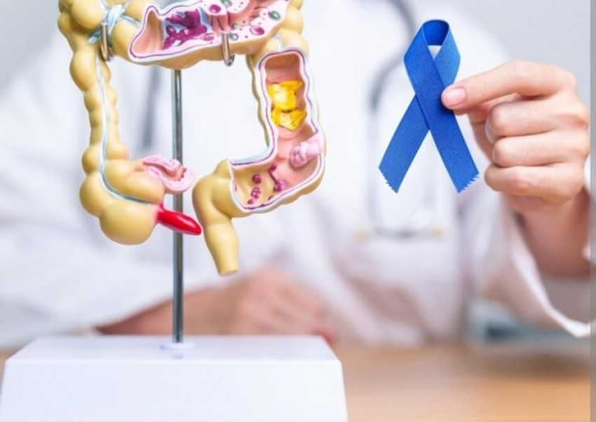 Deteksi Dini Kanker Prostat sebagai Pencegahan