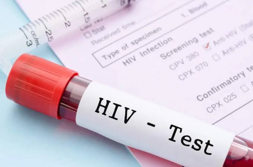 Ramai Isu Kasus HIV di Sidoarjo Meningkat, Kemenkes Beri Penjelasan