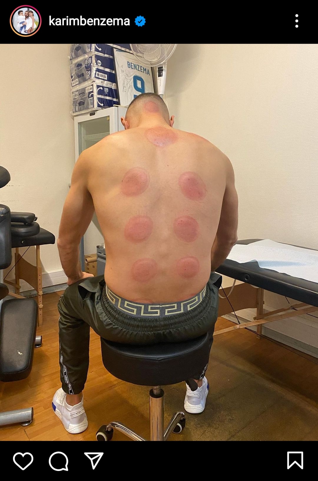 Rahasia Stamina Karim Benzema, Hobi Terapi Kesehatan ala Rasulullah