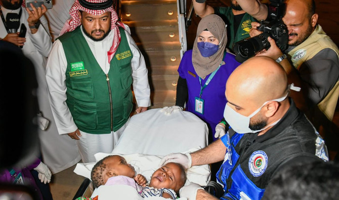 Si kembar siam tiba di Riyadh untuk Operasi Pemisahan Atas Bantuan Raja Salman