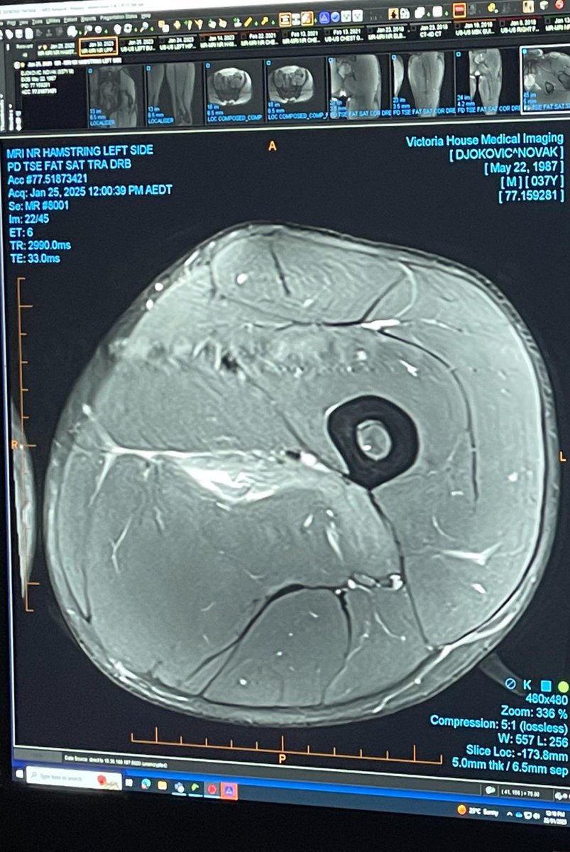 Pasca Australia Open; Sabalenka, Djokovic Didenda Ratusan Juta, Medvedev Didenda 1,9 Miliar