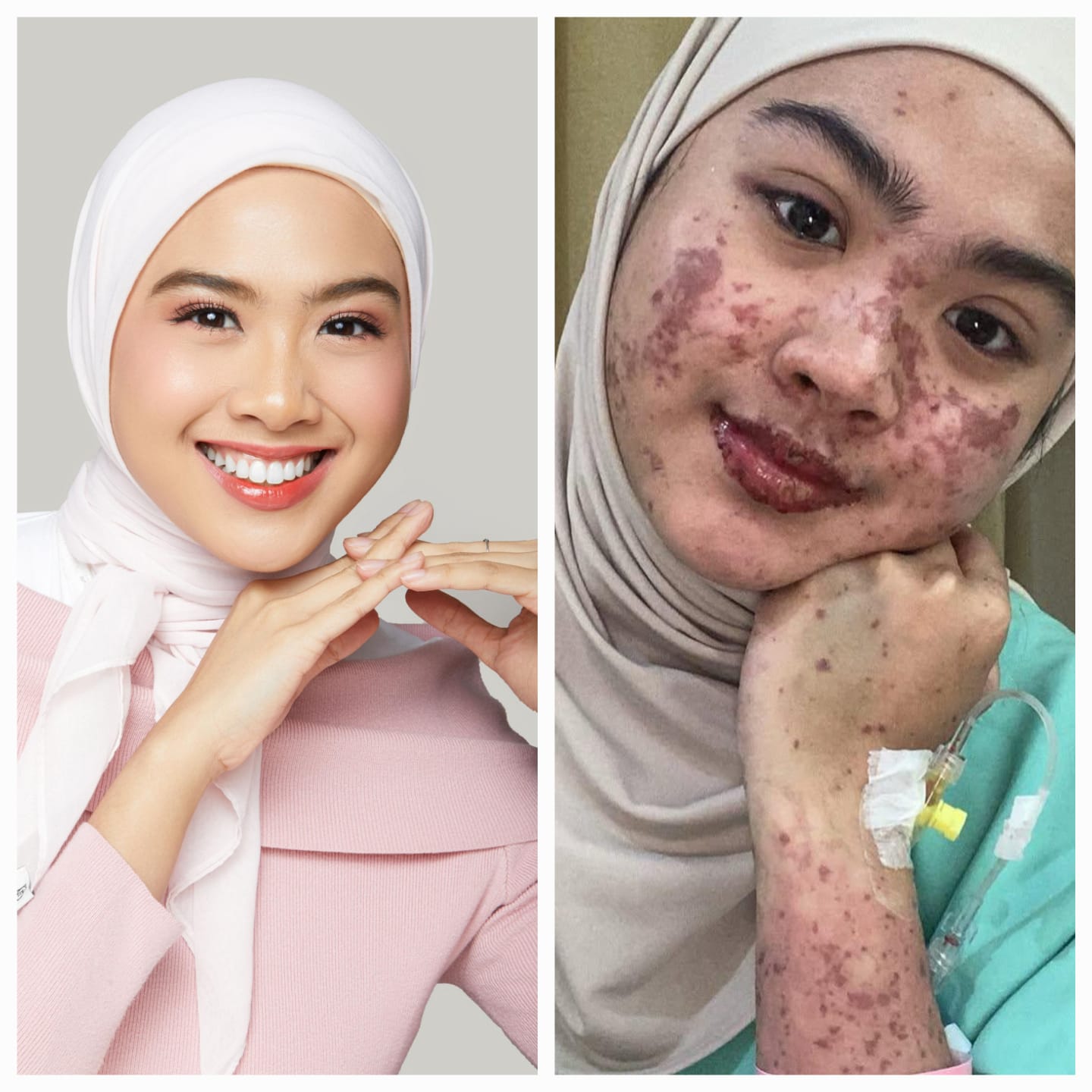 Afina Syifa, Finalis Miss Universe Indonesia: Bangkit dari Luka, Melangkah untuk Menginspirasi Indonesia